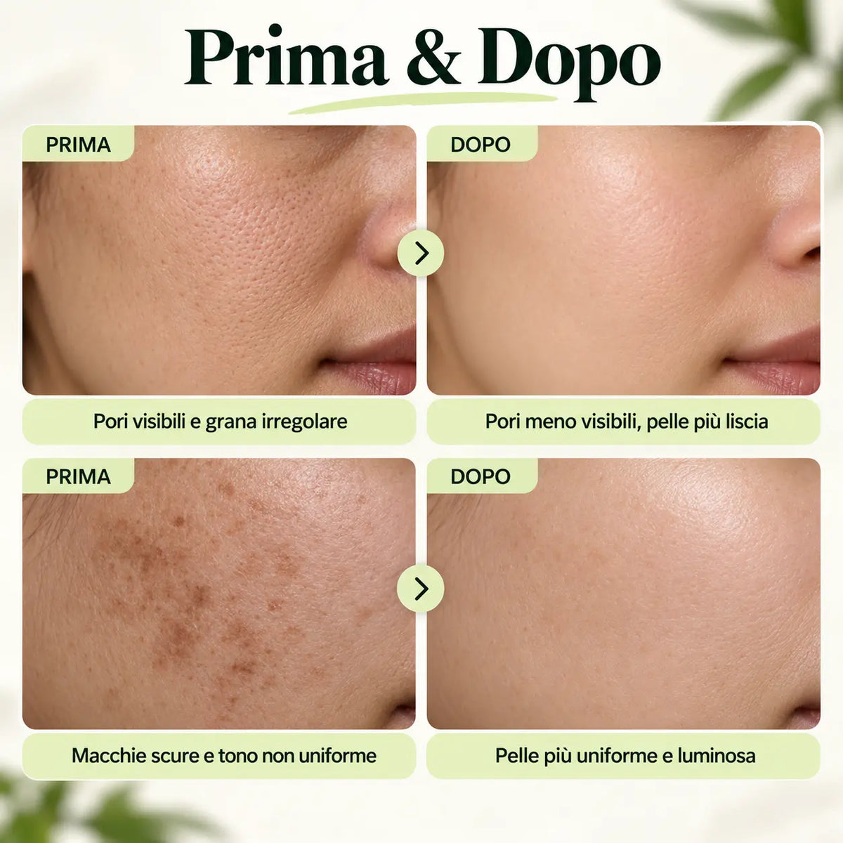 Prima / Dopo